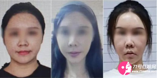 女子整容潜逃泰国