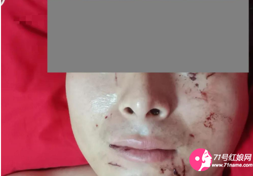 疑妻子有精神病退婚失败