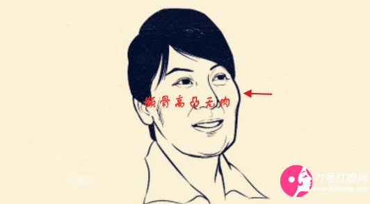 女相颧骨高凸而且无肉