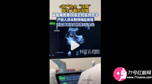 女子6次产检全正常却生下畸形女婴